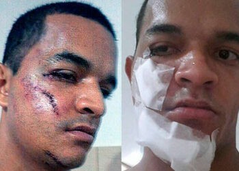 VIDEO – Un défenseur provoque 4 fractures faciales à son adversaire