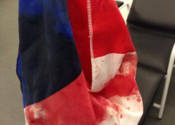 Un supporter français matraqué au Brésil !