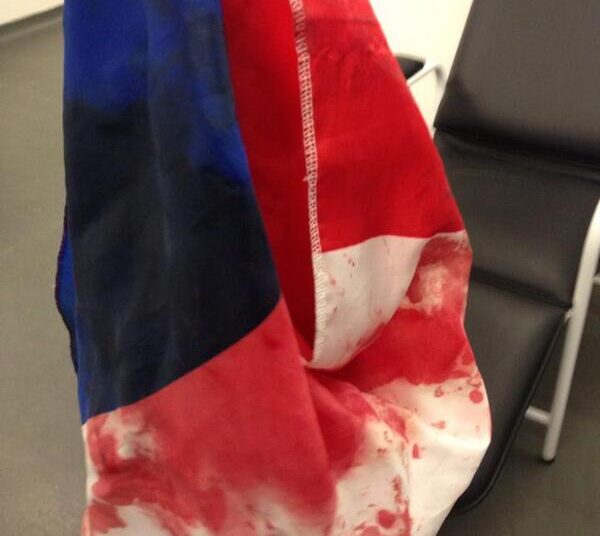 Un supporter français matraqué au Brésil !