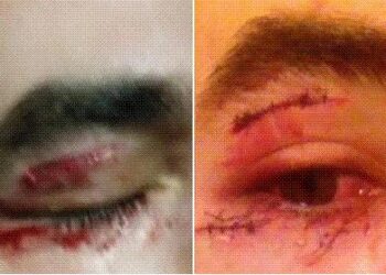 Un supporter parisien « frappé par des CRS » ?