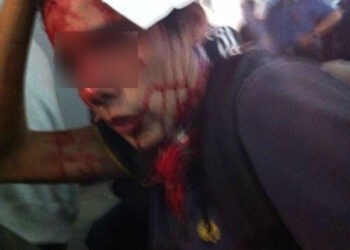 Pascal, supporter niçois à San Remo : « Les carabiniers se sont défoulés sur nous »