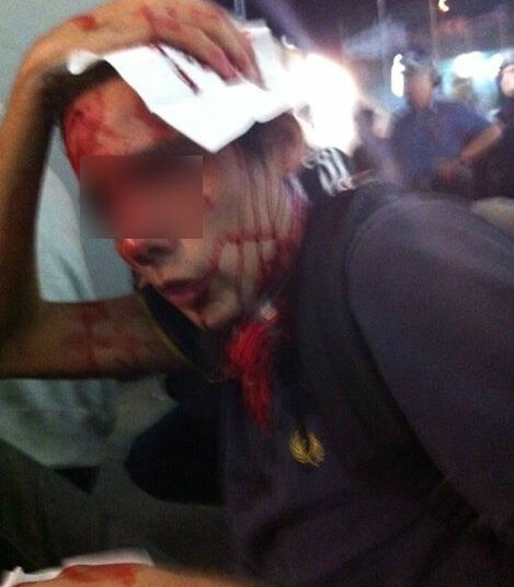 Pascal, supporter niçois à San Remo : « Les carabiniers se sont défoulés sur nous »