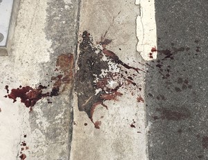 Botafogo-Flamengo : un supporter rubinegro perd la vue