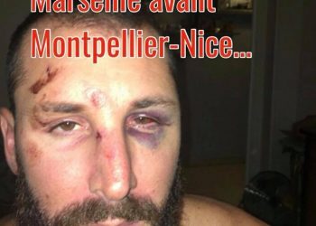Un supporter niçois « passé à tabac » par la SIR avant Montpellier-Nice