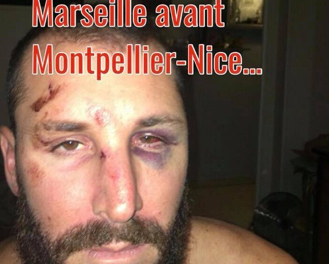 Un supporter niçois « passé à tabac » par la SIR avant Montpellier-Nice